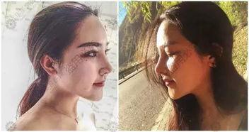 欧美鼻子医生图片,精湛技艺与艺术美学完美融合